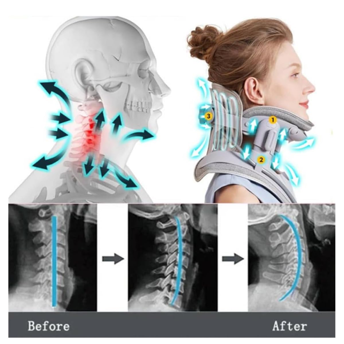 Cervical Neck Stretcher with 8 Airbags & Triple Traction